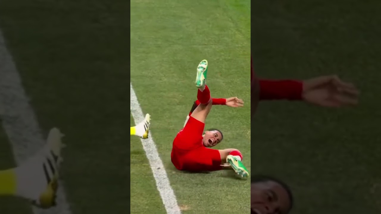 Jamal Musiala Suffered Injury 🚑