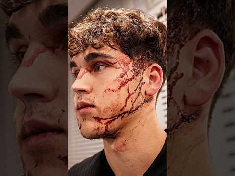 Pau Cubarsi injured 10 stitches #paucubarsi #cubarsi #barcelona #fcb #lamasia #football #injury #sad