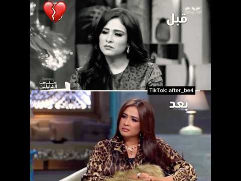 كلام ياسمين عن العوضي قبل وبعد الانفصال 💔 #احمد_العوضي #ياسمين_عبدالعزيز