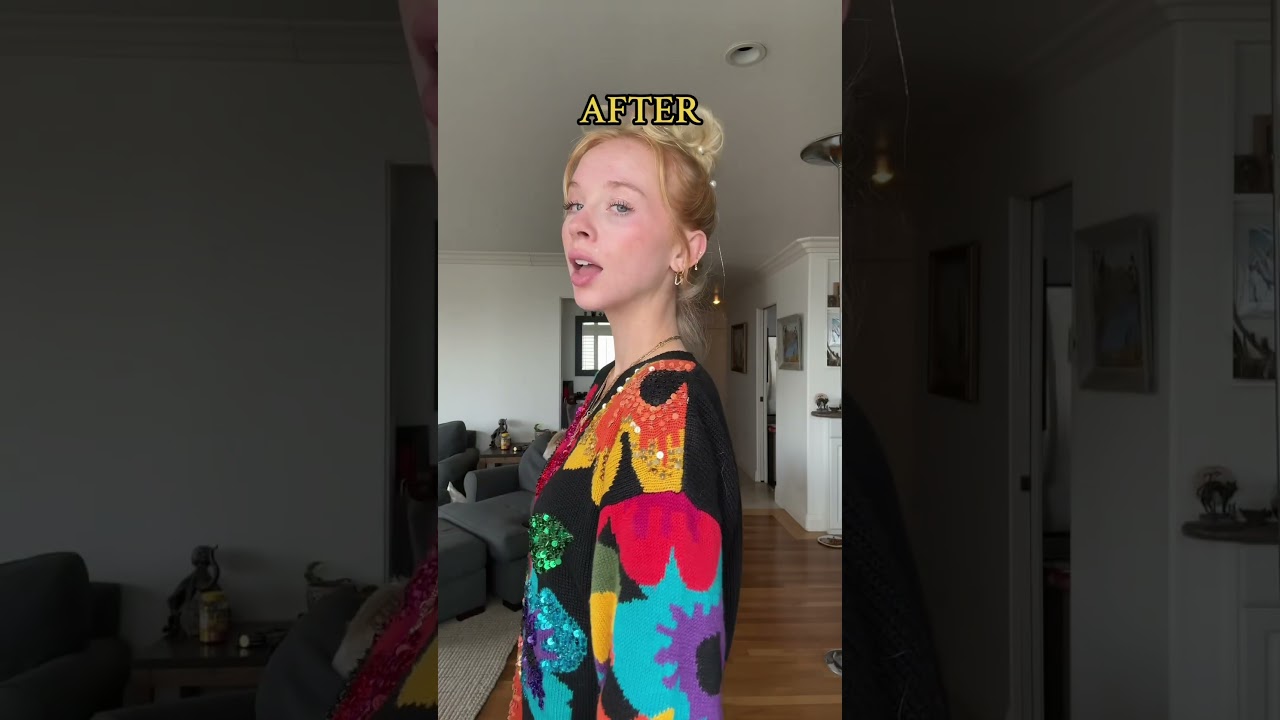 Chin Implant Transformation 🔥