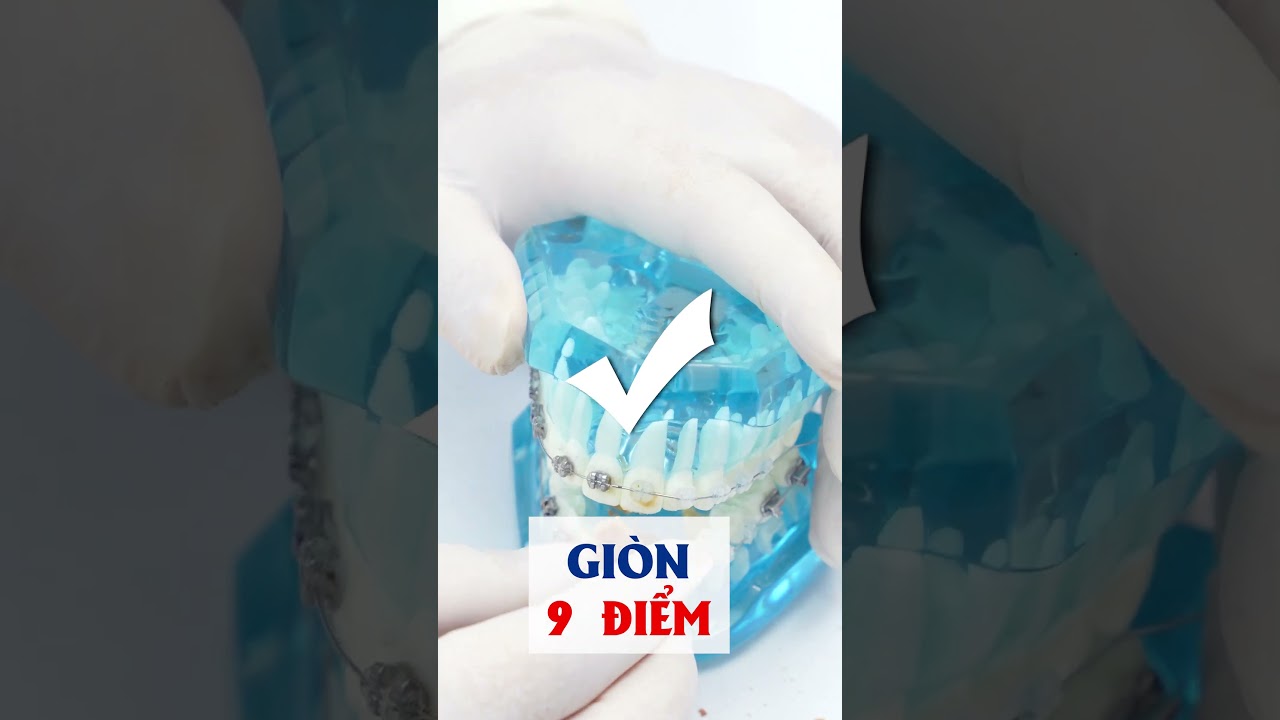 Thực Phẩm An Toàn Cho Răng Niềng 🦷