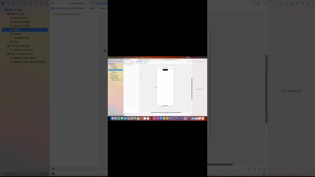UIButton iOS Step by Step