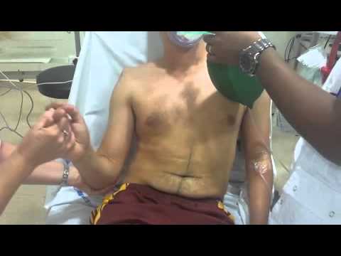 Comment Réduire une Luxation Antérieure de l'Épaule 🩺