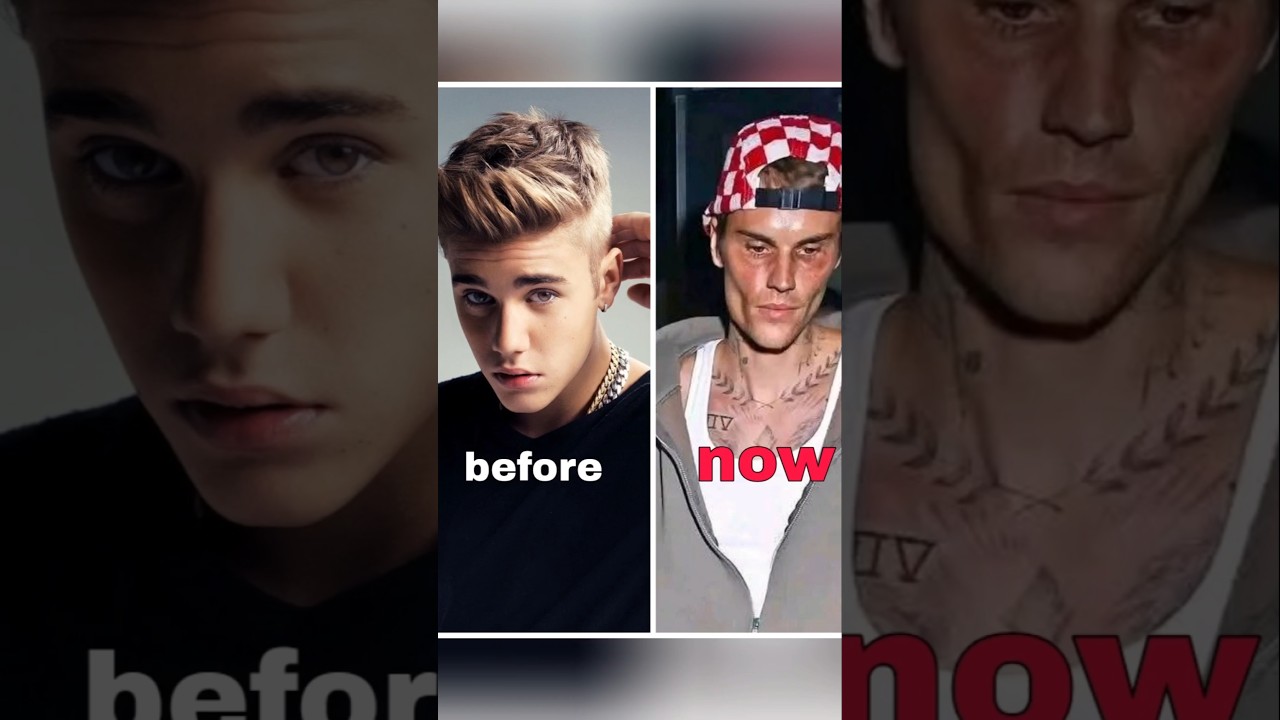 What’s Really Happening with Justin Bieber? 😢