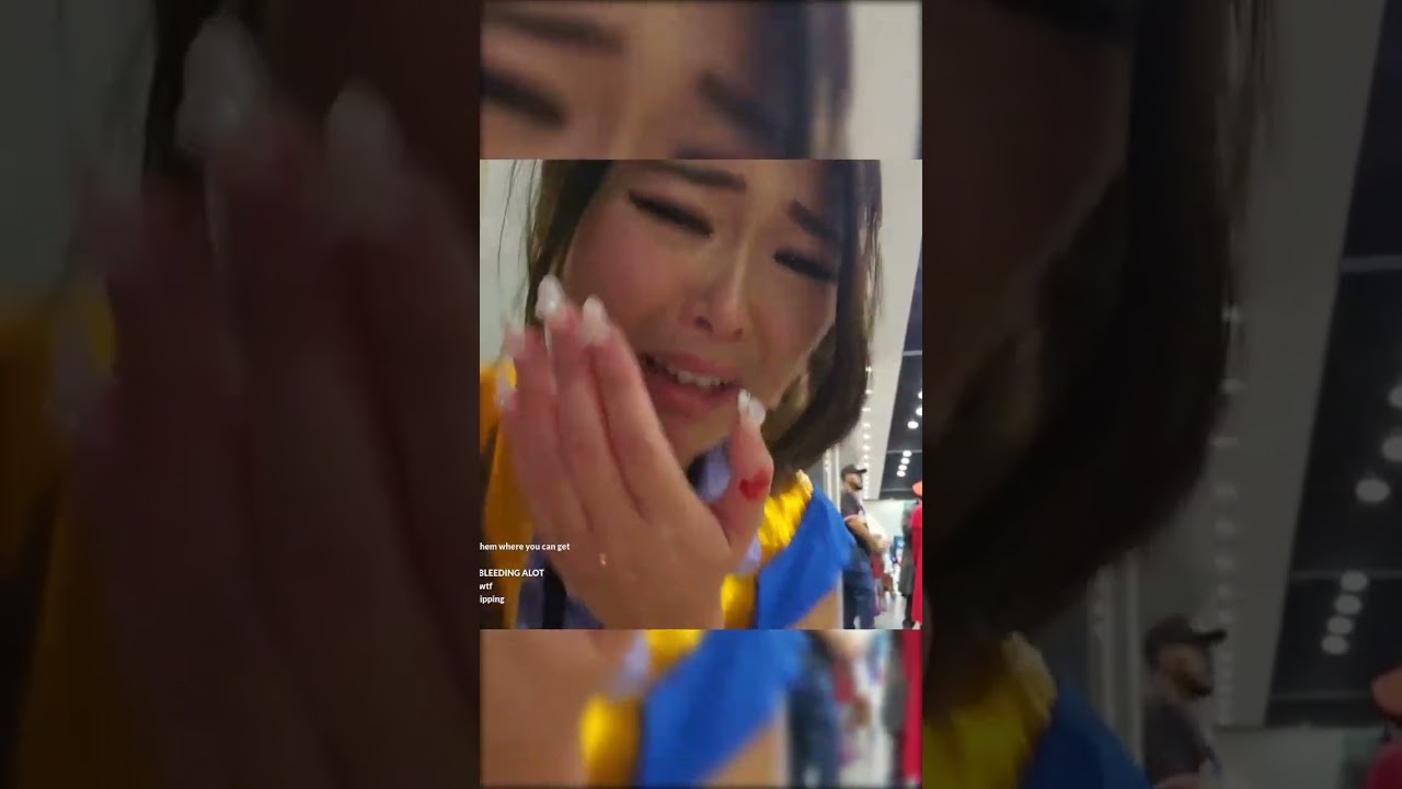 Extra Emily Gets Emotional After Injury at Comic Con 😢