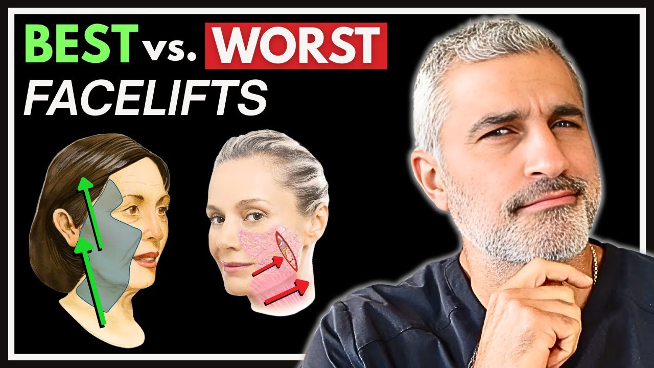 8 Facelifts Ranked from WORST to BEST! Plastic Surgeon Explains