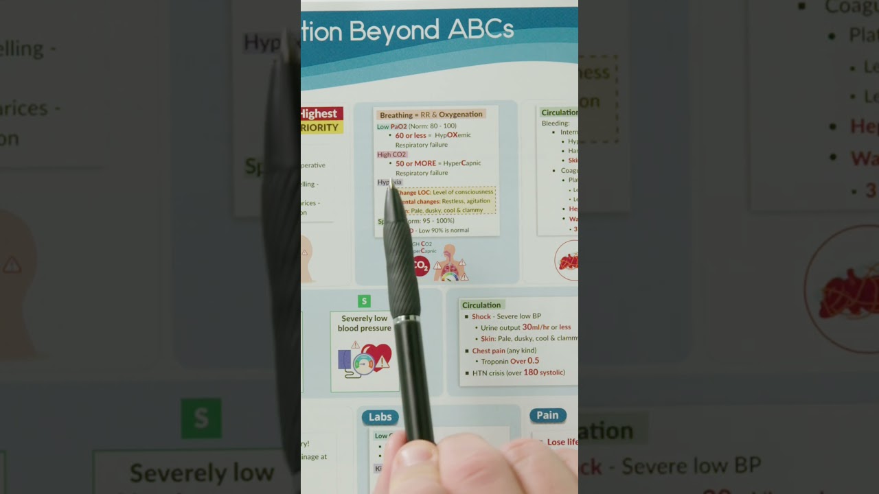 Prioritization Beyond the ABCs Study Guide Walkthrough