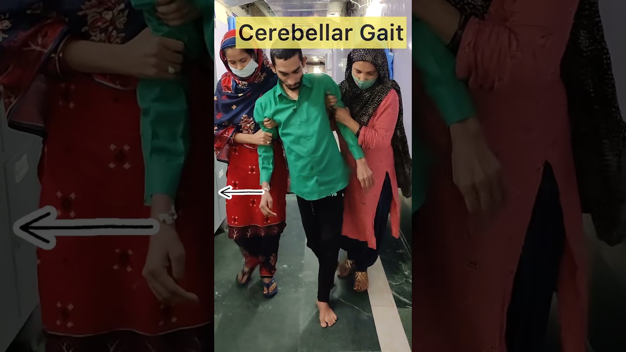 Cerebellar Gait & Ataxia 🧠