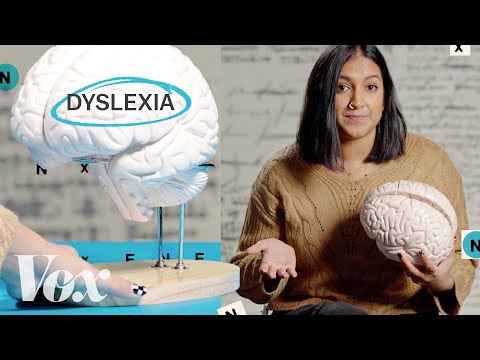 Understanding the Unique Brain Organization of Dyslexia