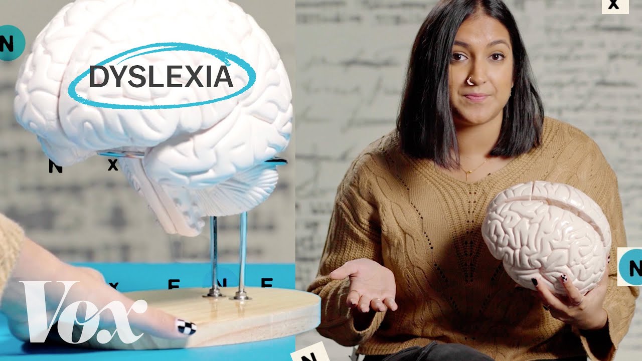 Understanding the Unique Brain Organization of Dyslexia