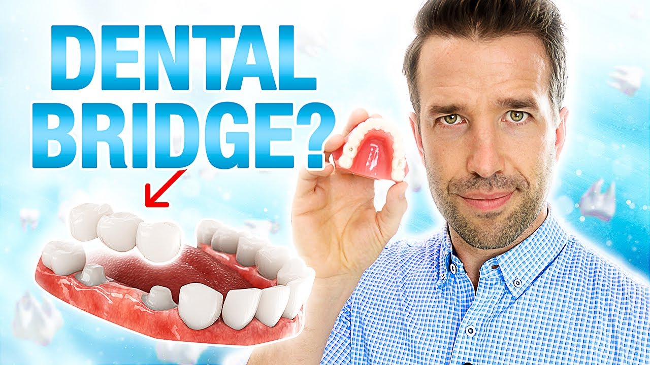 Dental Bridge Tips & Costs You Should Know 🦷
