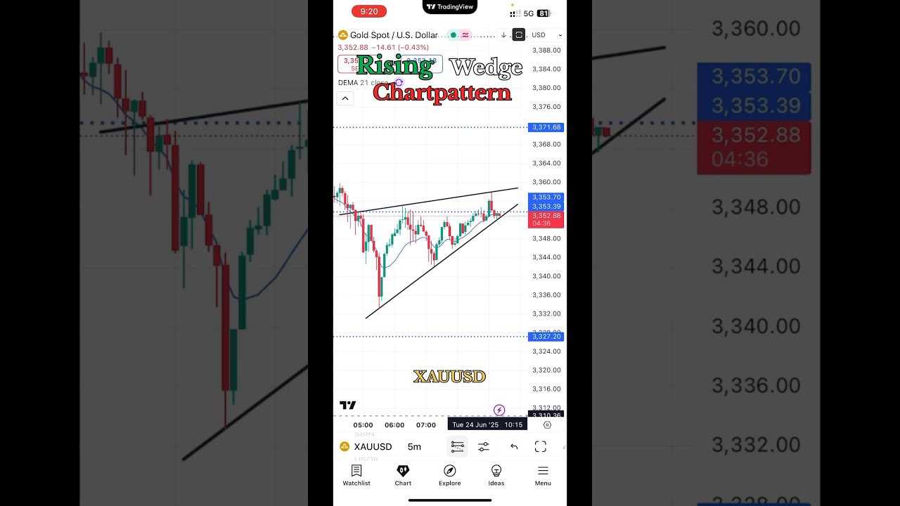 XAU/USD Breakout Strategy & Rising Wedge Pattern 🔥