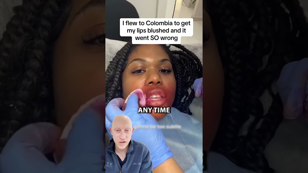 Lip Blushing Gone Wrong? | Surgeon Reacts ๐