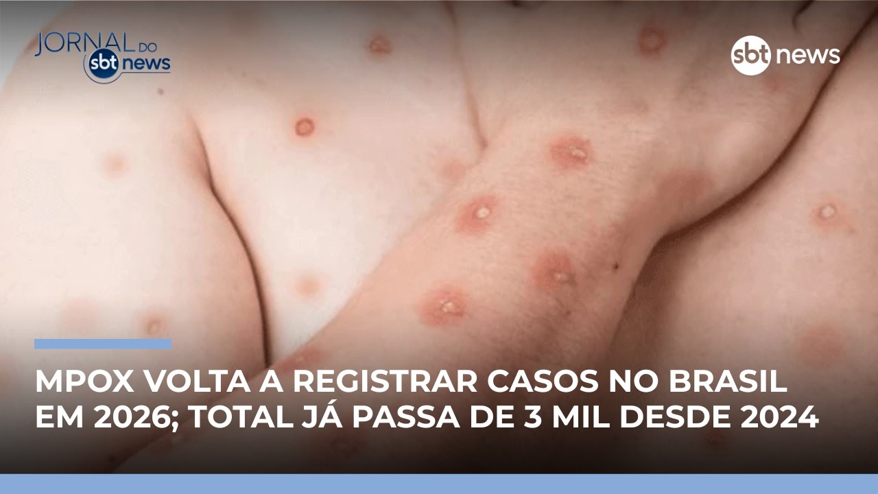 Brasil registra 46 casos de mpox em 2026 | #JornaldoSBTNews