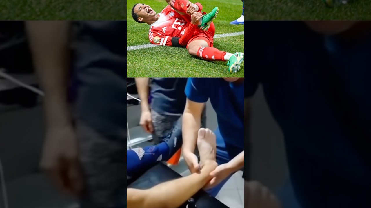 Jamal Musiala Sidelined Due to Injury ⚽