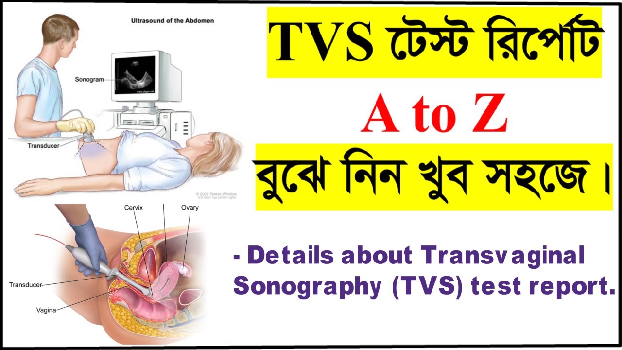 TVS রিপোর্ট বোঝার সহজ উপায় 🩺