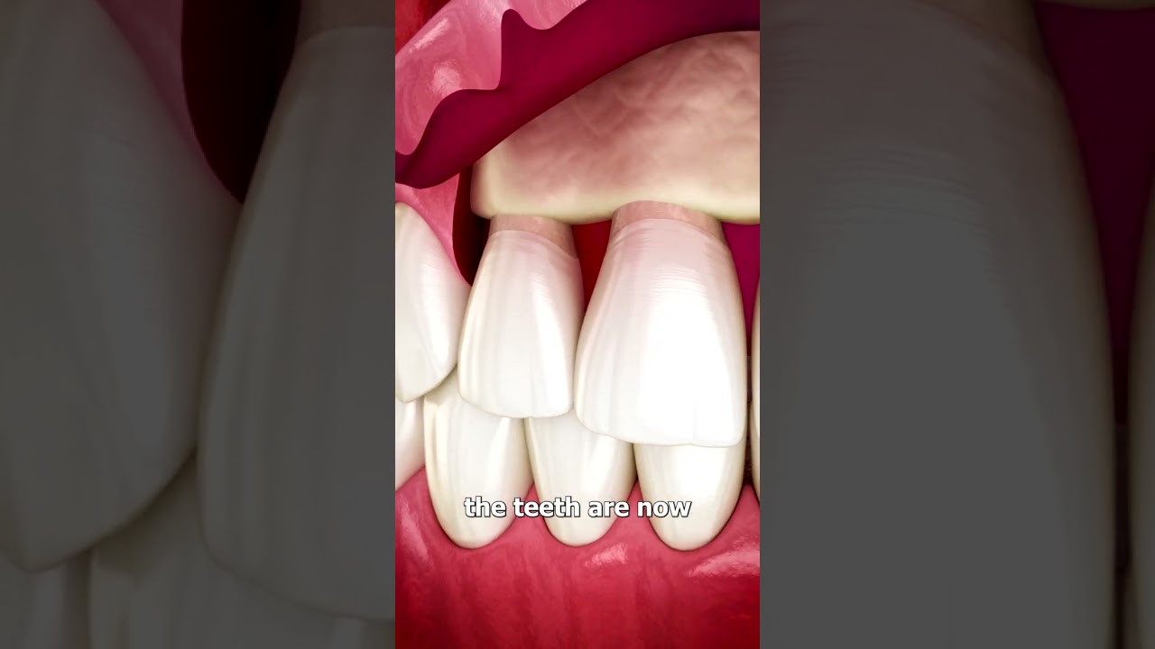 Teeth-Enhancing Surgery ๐จ