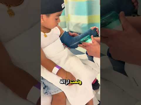 الولد يخاف من منشار الجبس 😨 لكن رد فعل الطبيب كان غير متوقع! 🤯 | لحظة مضحكة ومريحة ❤️ #shorts
