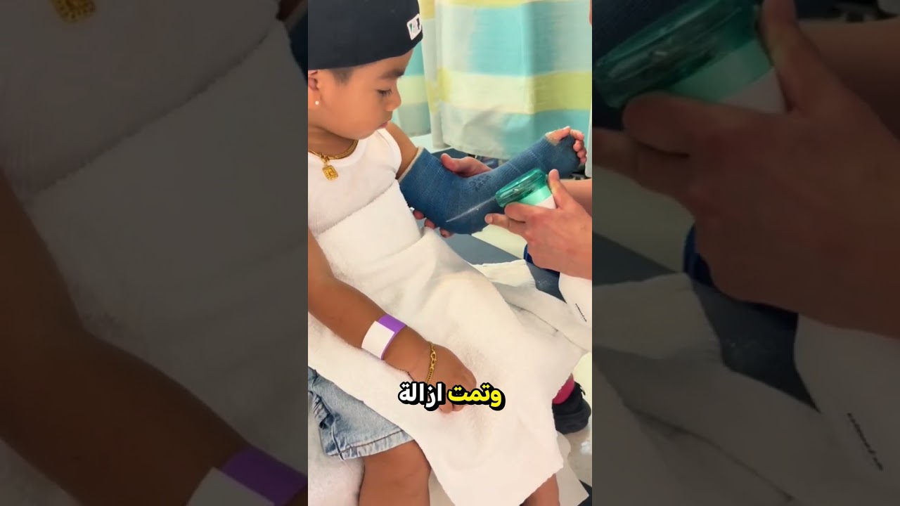رد فعل الطبيب المدهش على خوف الطفل من منشار الجبس 😨✨