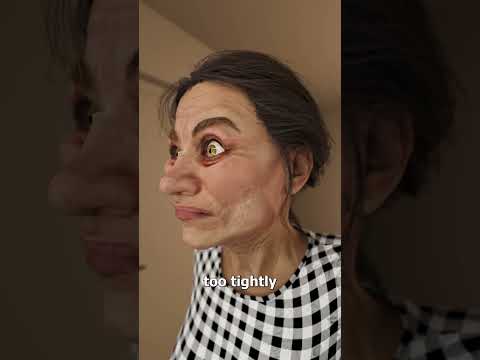 The Facelift That Left Her Eyes Stuck Open 😳