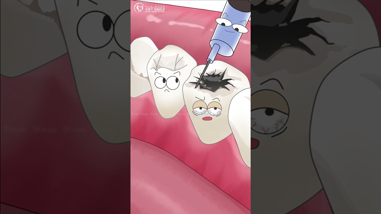 Sâu răng có nhất thiết phải nhổ răng? #nhakhoavietsmile #saurang