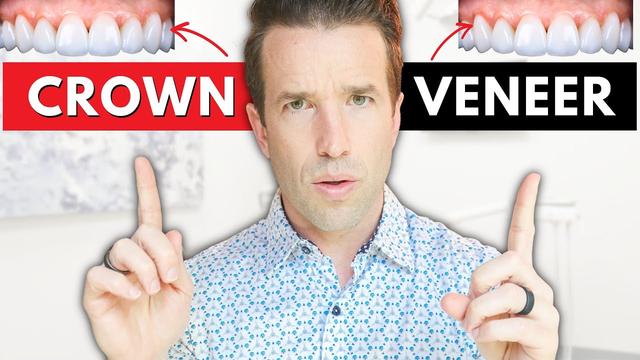 Veneers vs Crowns: Which Dental Solution Is Best? 🦷