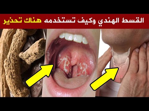 تناولوا القسط الهندي ولكن لا ترتكبوا الخطأ الذي يرتكبه الملايين من البشرفوائد القسط وطريقة استخدامه