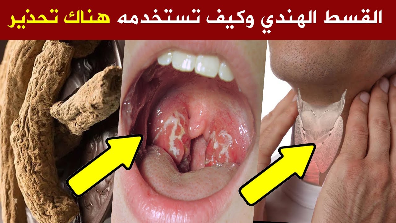 اكتشف فوائد القسط الهندي وكيفية استخدامه بشكل صحيح 🧡