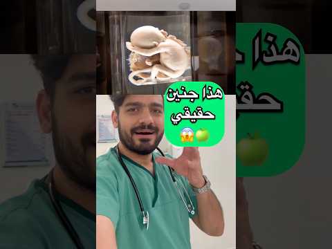جنين حقيقي 😱🍏 #اكسبلور #دكتور_نبهان #doctor #جنين