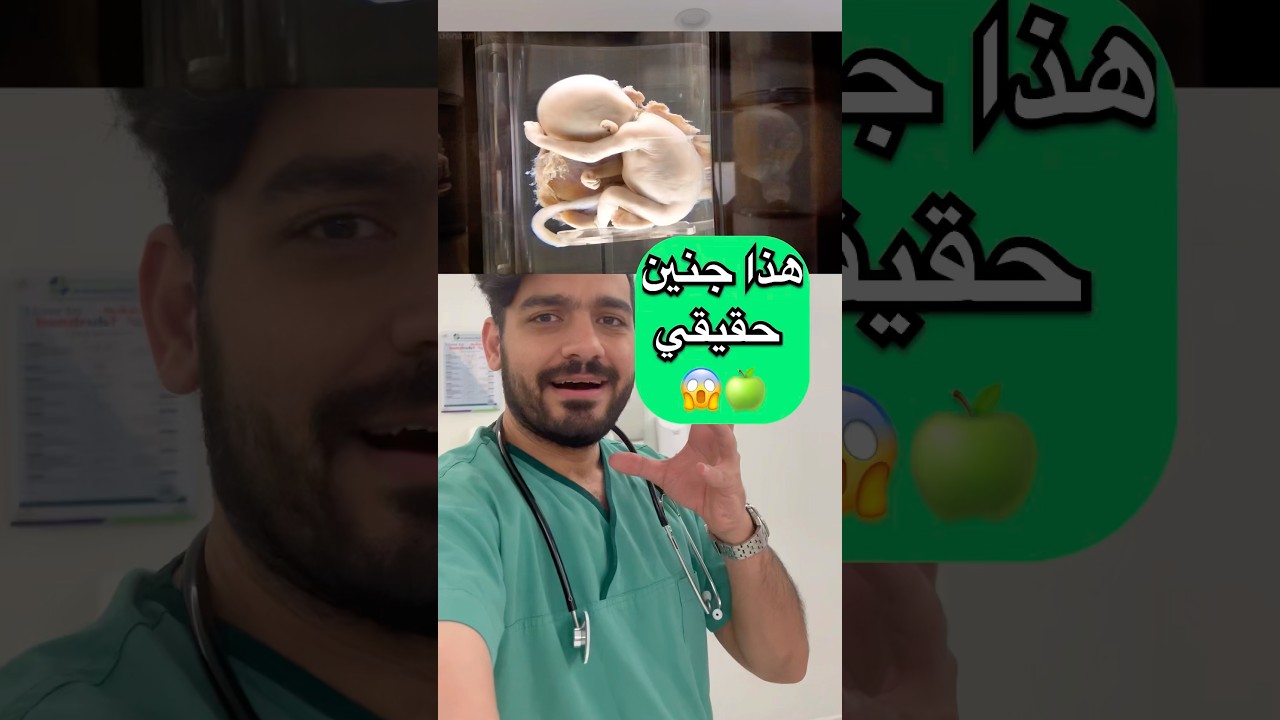 هل تصدق وجود جنين حقيقي؟ 😱 اكتشف الحقيقة مع دكتور نبهان
