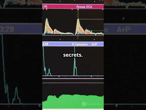 Side Channel Attacks: Hacking Without Touching Your Data – The Silent Attack! #shorts