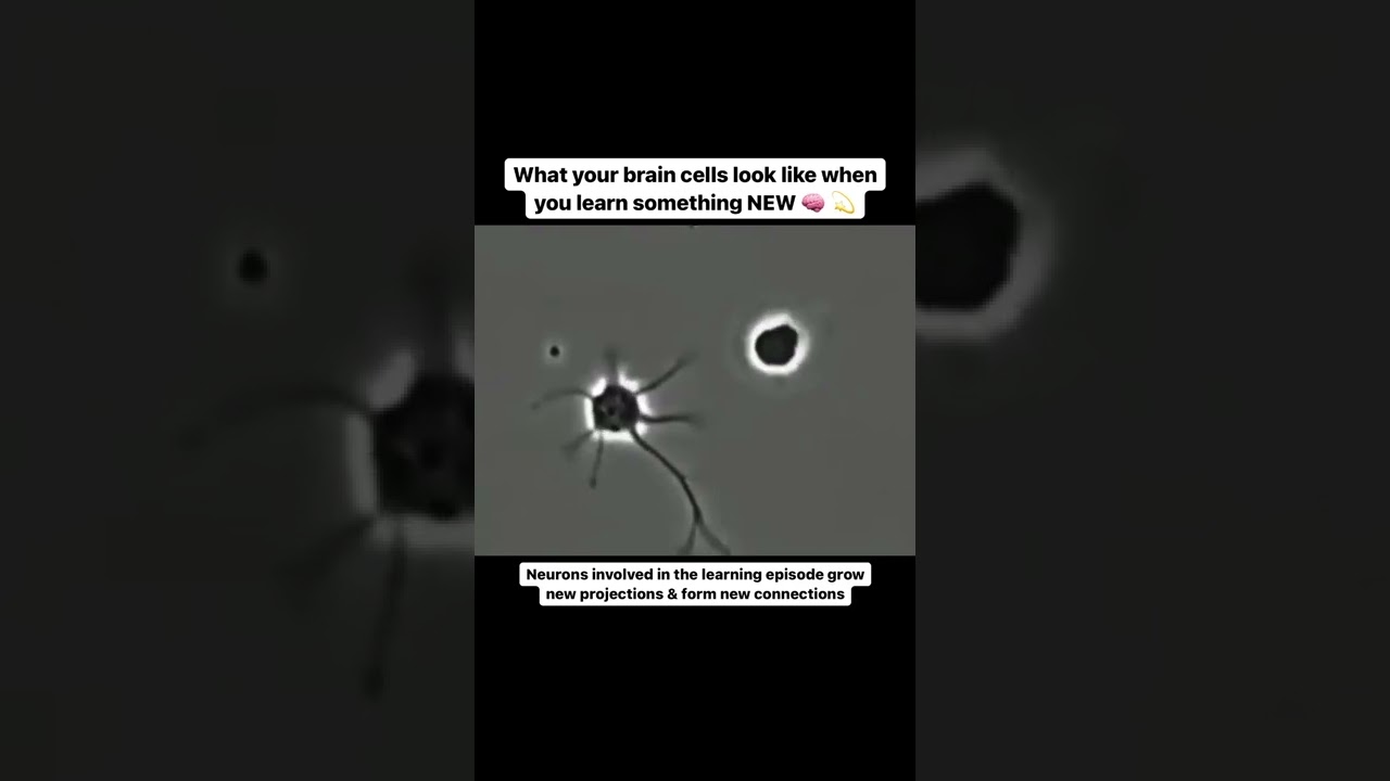 Brain Cells Change When You Learn Something New 🧠