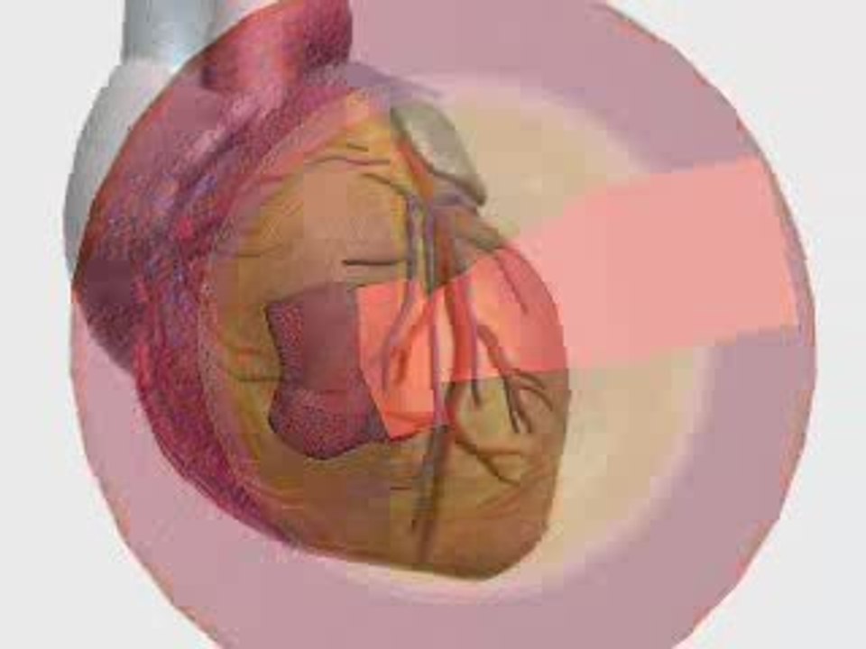 Heart Attack: Causes and Prevention ❤️