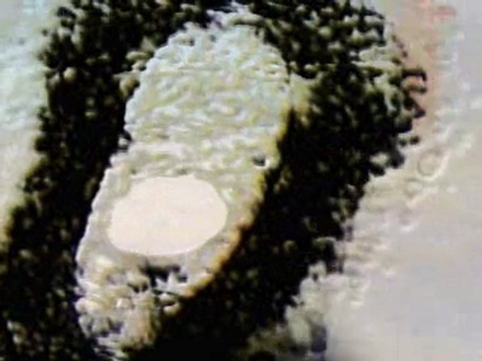 hcg injections for weightloss and hcg side effects for hcg