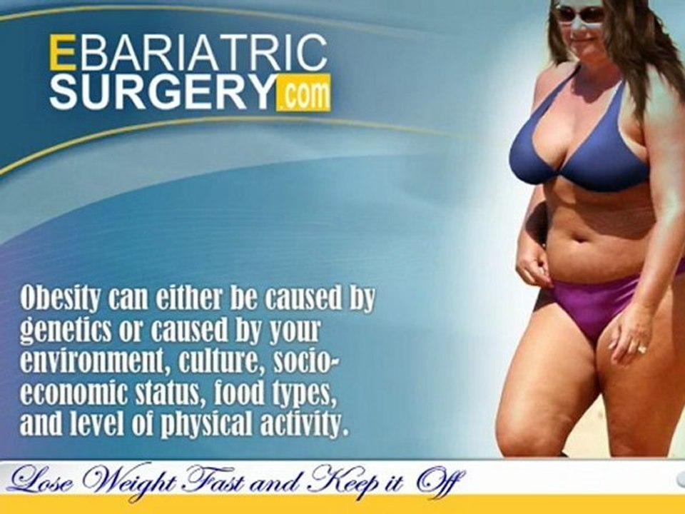Bariatric Surgery