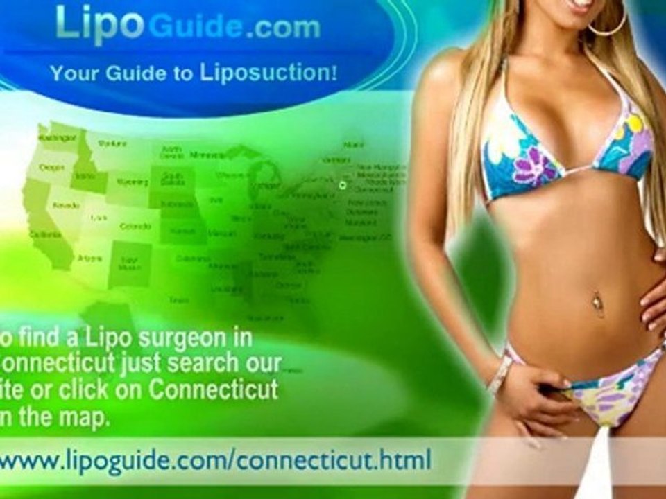 Lipo Connecticut
