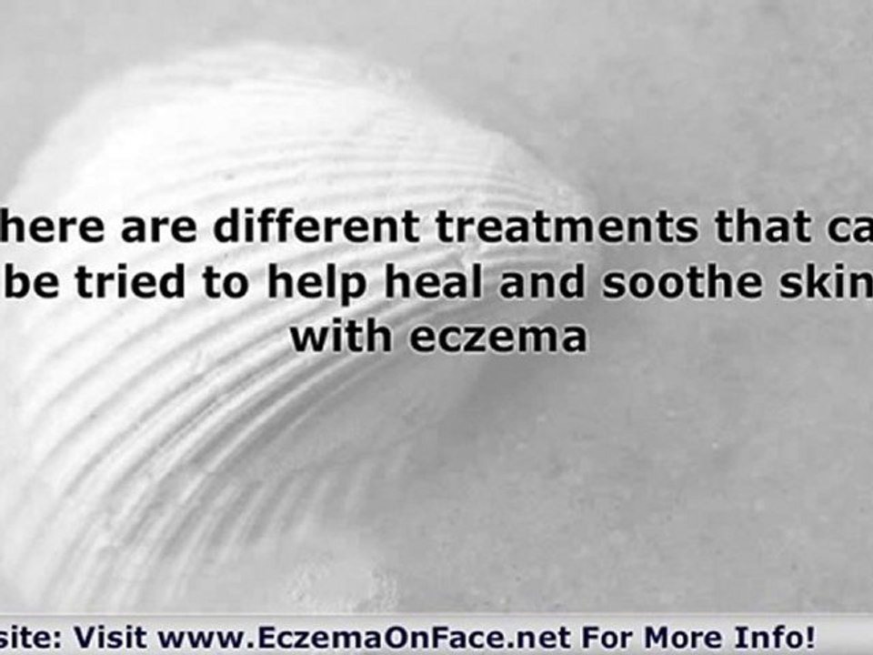 Eliminating Eczema Is Easy!