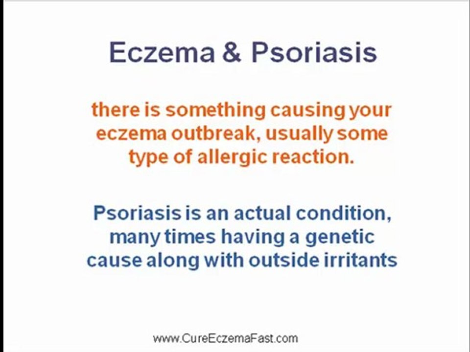 Eczema and Psoriasis - The Main Differences