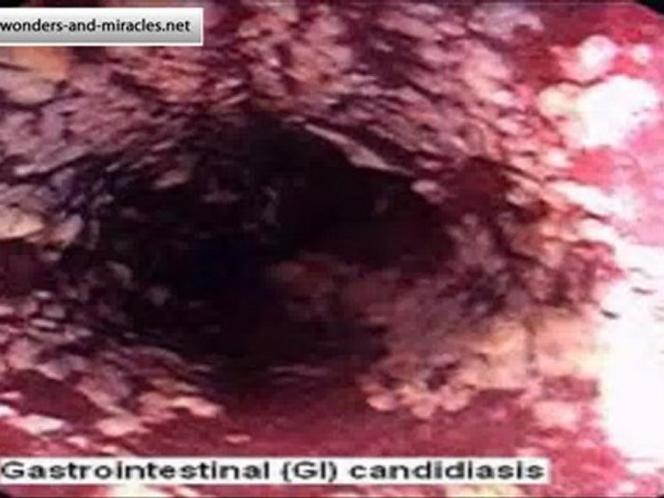 inflammation and infection.