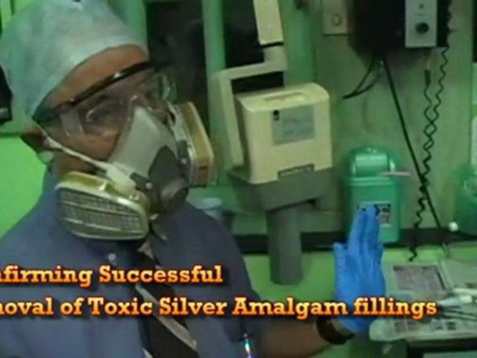 Silver Filling Toxicity, Removal and Me