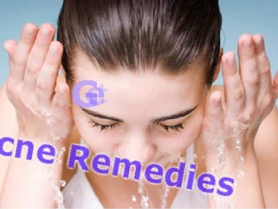 Effective Remedies for Acne 🌟