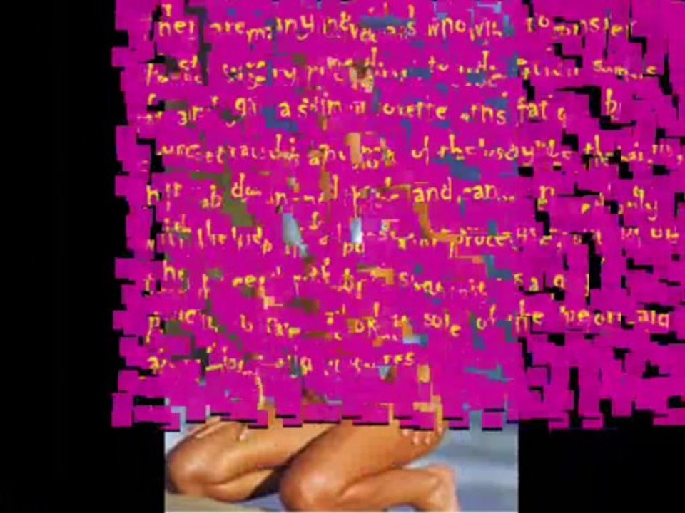 Comparing before and after pictures of liposuction and tummy tuck