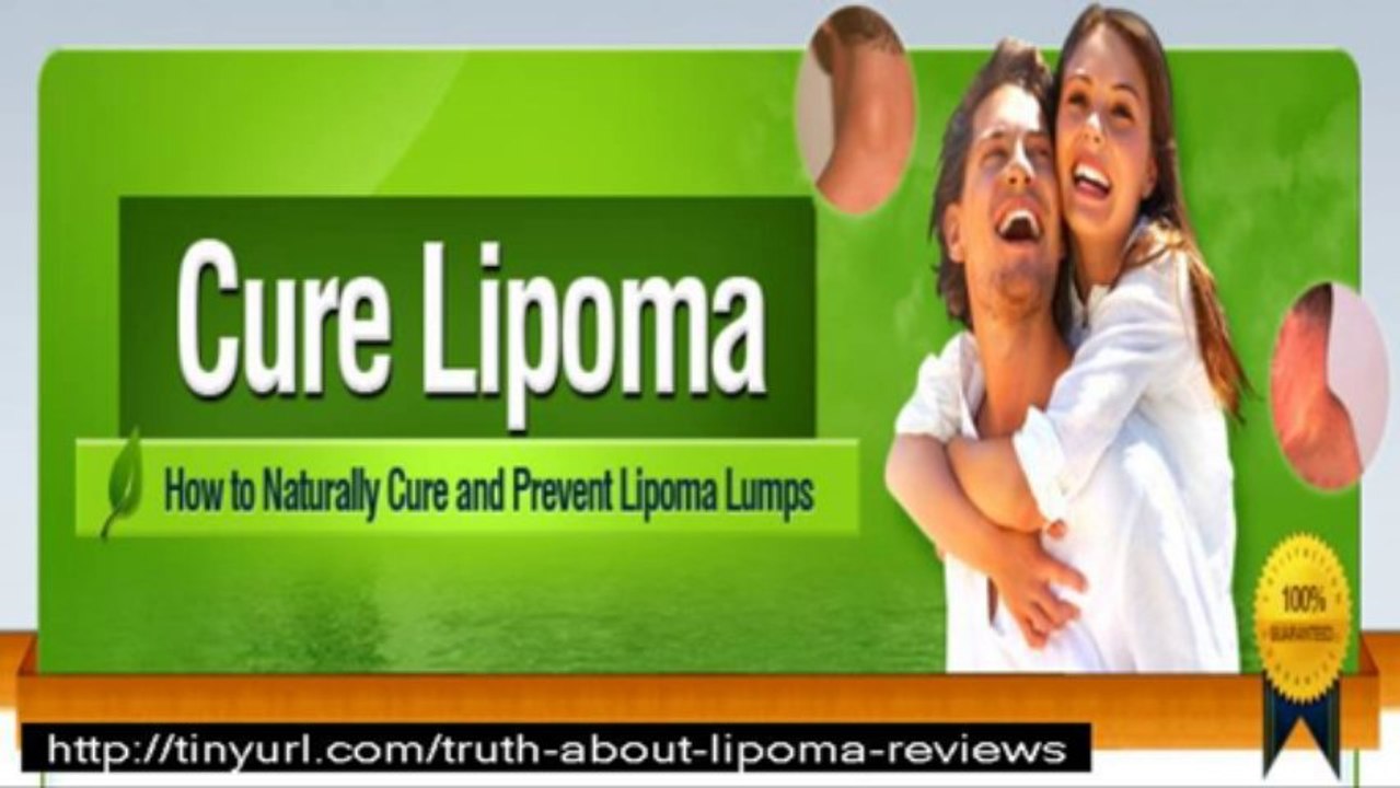 lipoma pdf download + how to get lipoma
