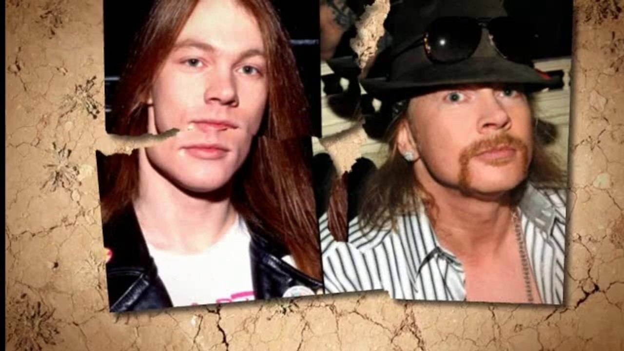 Types Of Plastic Surgery