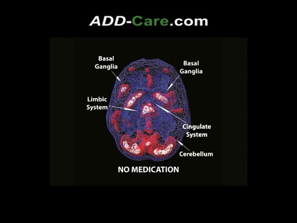 history-of-add-and-the-6-types
