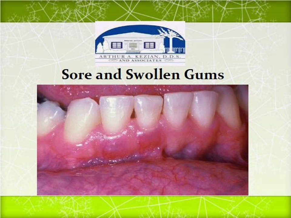 Types of Dental Emergencies in Los Angeles