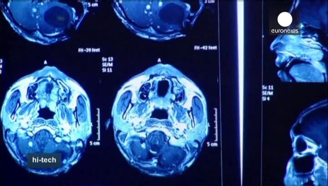 Brain to brain communication edges closer