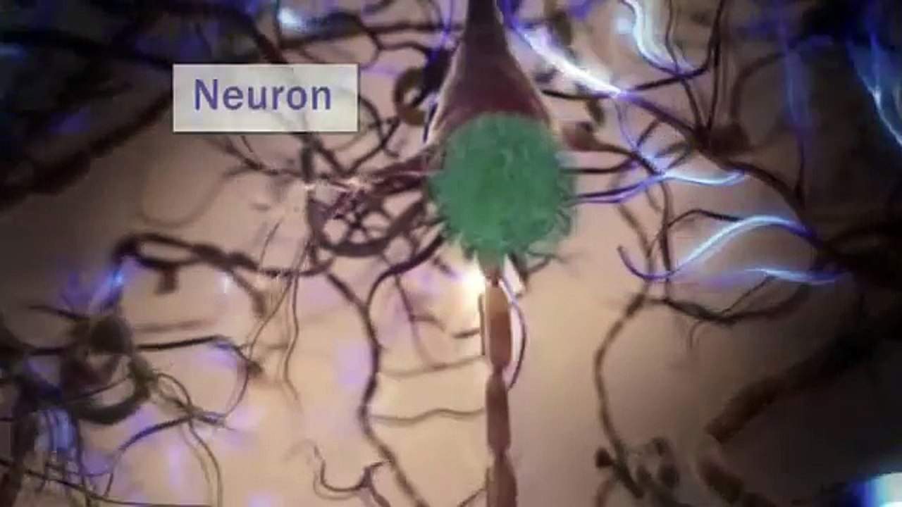 what is Alzheimer's Disease