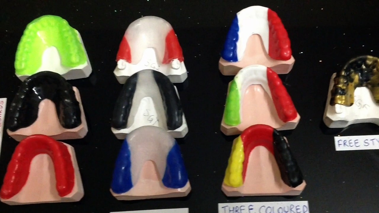 Types of Mouth Guards