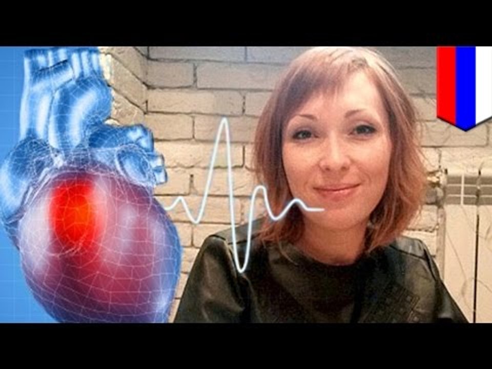 Россиянка с кардиостимулятором погибла, пройдя через металлодетектор в аэропорту